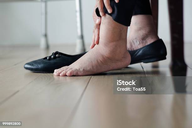 Photo libre de droit de Femme Âgée Les Mettre Sur Les Chaussures De Pieds Enflée banque d'images et plus d'images libres de droit de Enflure