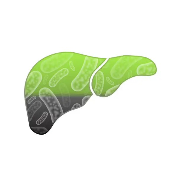 Vector illustration of Bad human liver