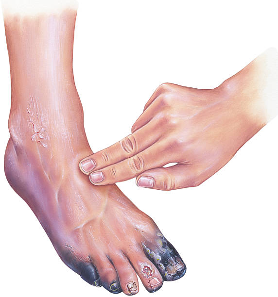 a kezelés foot nail fest