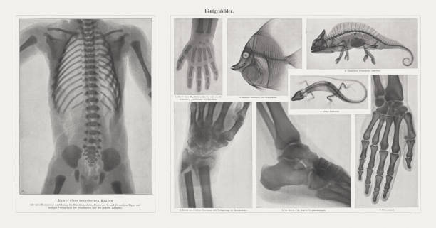 Early x-rays, raster prints, published in 1898 Early x-rays, left: Hull of a newborn boy with imperfectly trained bones. Right: 1) Hand of a 2.5 year old child with imperfectly trained bones; 2) Zanclus cornutus, a south sea fish; 3) Chameleon (Chamaeleo cristatus); 4) Green lizard, 5) Fracture of the right forearm with displacement of the fragments; 6) In the left foot ingrown bullet; 7) Woman's hand. Raster prints, published in 1898. spine body part photos stock illustrations