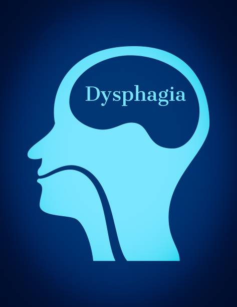 stockillustraties, clipart, cartoons en iconen met illustratie voor dysphagia en logopedie - choking