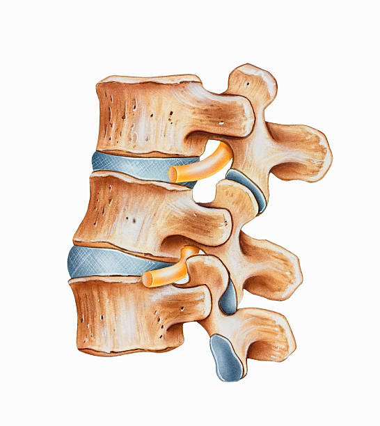 Spine - Lumbar Hyperlordosis Lumbar hyperlordosis is an exaggerated curvature of the lumbar spine most often involving the L3, L4, and L5 vertebrae. Shown on the top is an open foramen and a free nerve root allowing flexion; on the bottom is a foramen narrowed by the superior articular process of the superior articular process and its compressed root nerve. spine body part stock illustrations