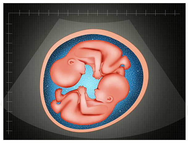 ultrasound of twins Illustration of ultrasound twins stock illustrations