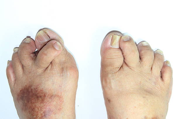 Ugly guys have feet do why 24 Beautiful
