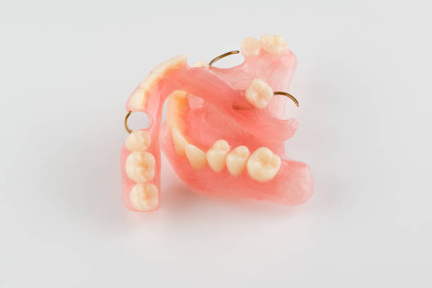 acrylic dental prosthesis stock photo