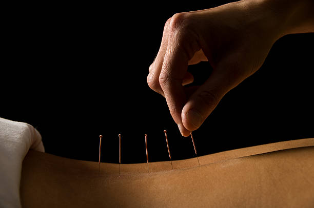 Acupuncture  acupuncture stock pictures, royalty-free photos & images