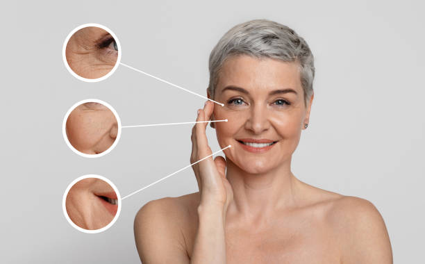 Aged Skin Care. Collage of beautiful mature woman with zoomed wrinkles zones Aged Skin Care. Creative collage of beautiful mature woman's portrait with zoomed wrinkles zones over light background imperfection stock pictures, royalty-free photos & images