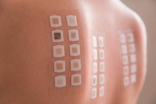 Allergy patch test on the back of a young woman Dermatological tests to detect certain types of allergies allergy test stock pictures, royalty-free photos & images