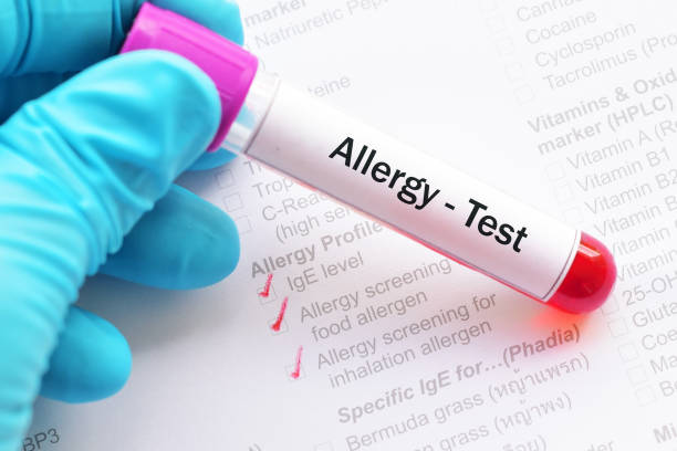 Allergy test Blood sample for allergy profile test allergy test stock pictures, royalty-free photos & images