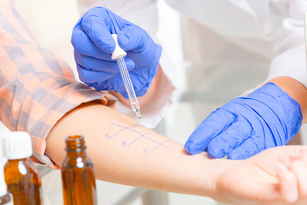 Allergy tests in laboratory Medical doctor doing allergy tests in laboratory allergy test stock pictures, royalty-free photos & images