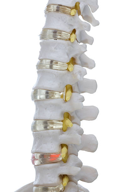 Anatomical model of human spine on white background. Anatomical model of  a section of the human spine on white background. Nerves in yellow. cauda equina photos stock pictures, royalty-free photos & images