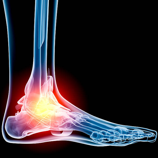 Ankle in pain x-ray Digital medical illustration: Lateral (side) x-ray view (orthogonal) of human foot and ankle. With pain zone in ankle. Featuring: lateral surface photos stock pictures, royalty-free photos & images
