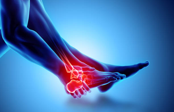 Ankle painful - skeleton x-ray. Ankle painful - skeleton x-ray, 3D Illustration medical concept. ankle stock pictures, royalty-free photos & images
