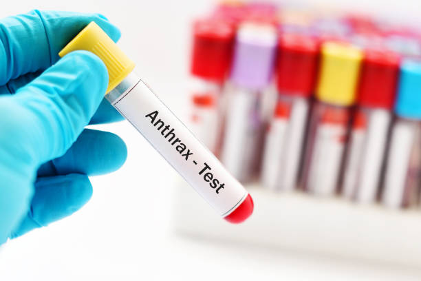 Anthrax test Blood sample for anthrax bacteria test Anthrax stock pictures, royalty-free photos & images