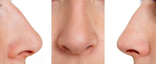 Aquiline nose stock photo