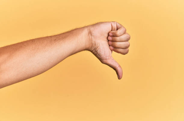 Arm and hand of caucasian man over yellow isolated background doing thumbs down rejection gesture, disapproval dislike and negative sign stock photo