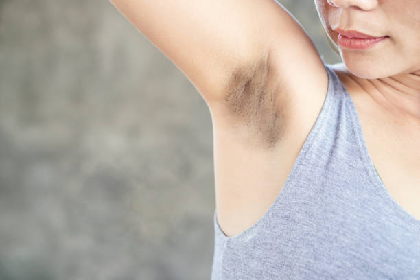 Asian woman having skin problem with black armpits Asian woman having skin problem with black armpits armpit stock pictures, royalty-free photos & images