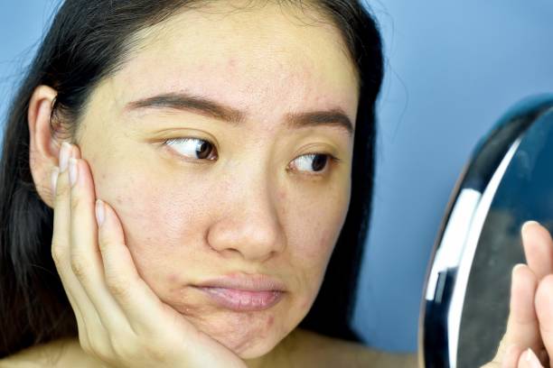 Asian woman looking at herself in the mirror, Female feeling annoy about her reflection appearance show the aging facial skin signs, wrinkles, dark spot, pimple, acne scar, large pores, dull skin. stock photo