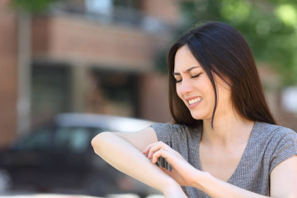 Asian woman scratching itchy arm in the street stock photo