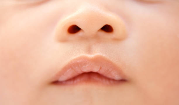 Chapped lips of baby