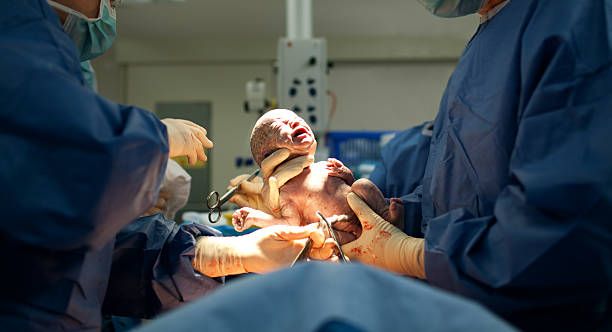 Baby being born via Caesarean Section Baby being born via Caesarean Section coming out childbirth stock pictures, royalty-free photos & images