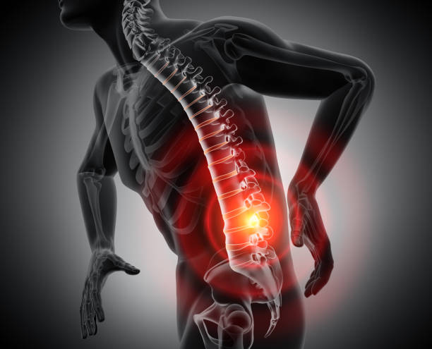 Back pain - conceptual artwork - 3d illustration 3d render human spine anatomy with pain symptoms - side view - Grayscale Image hip body part stock pictures, royalty-free photos & images