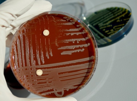 E.coli and Klebsiella pneumonia grown on agar plates.