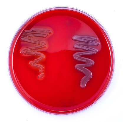 細菌ベータ hemolysis 羊の血液寒天培地 - ストックフォト・写真素材...