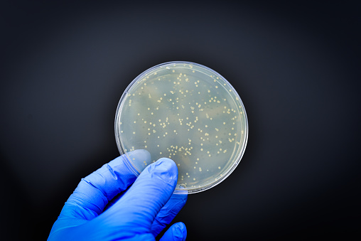 Researcher displaying bacterial culture plate in microbiology food safety laboratory