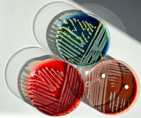 Three bacterial culture plates.