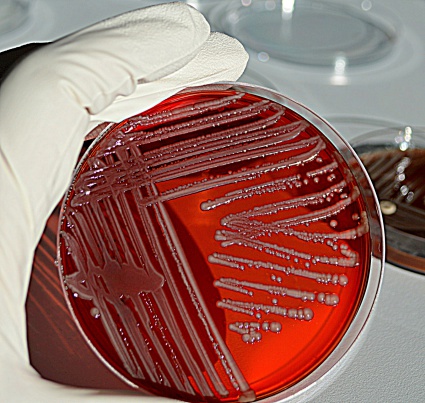 Bacteria grown on a blood agar plate.