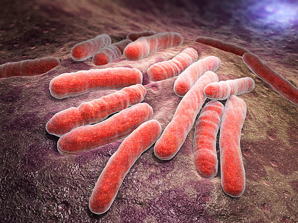 Bacterial infection tuberculosis stock photo