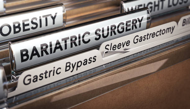 Bariatric Surgery Types, Gastric Bypass Or Sleeve Gastrectomy. 3D illustration of a folder with focus on a tabs with the texts bariatric surgery, gastric bypass and sleeve gastrectomy. Types of surgical operation used for obesity. surgery stock pictures, royalty-free photos & images