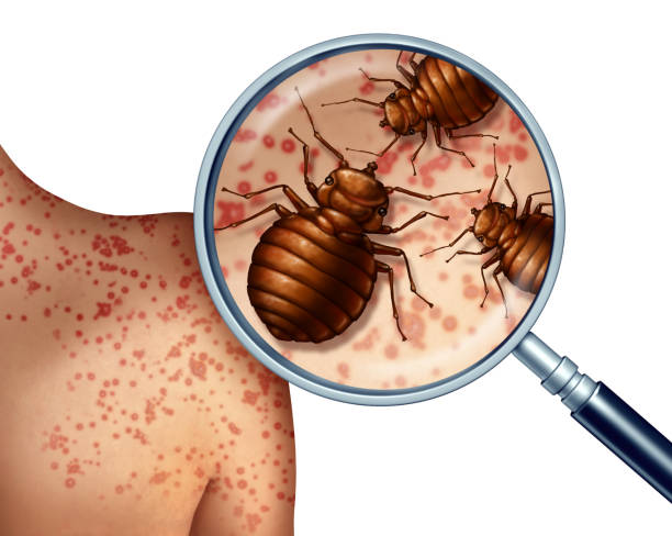 Bed Bug Bites Bed bug bites on human skin  or bedbug infestation concept as a magnification close up of  parasitic insect pests as a hygiene symbol and health danger of bloodsucking parasites with 3D illustration elements. bed bug infestation stock pictures, royalty-free photos & images