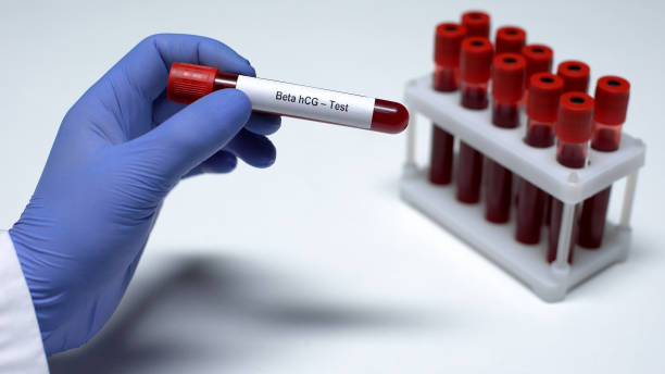 prueba de hcg beta, médico que muestra muestra sangre en tubo, investigación de laboratorio, chequeo de salud - abortion clinic fotografías e imágenes de stock