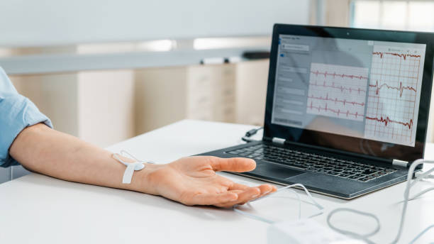 Biofeedback - Female hand with attached sensors for heart rate measurement. stock photo