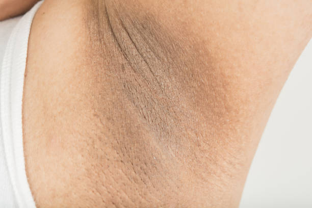 Black armpit skin Black armpit skin armpit stock pictures, royalty-free photos & images