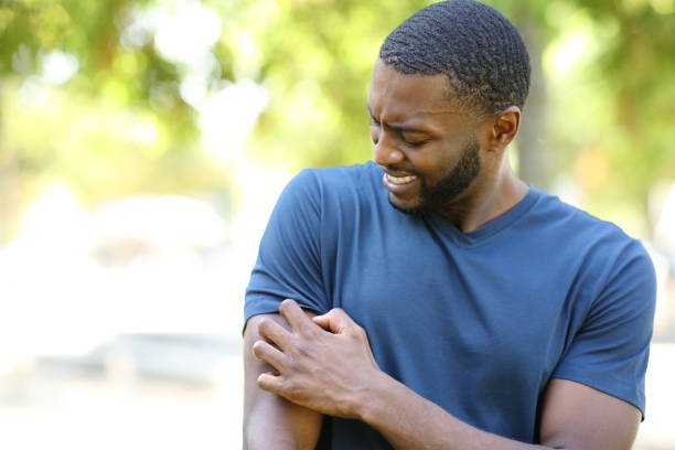 Black man scratching itchy arm in a park stock photo