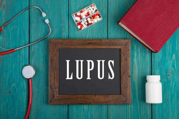 Blackboard with text "Lupus", book, pills and stethoscope on blue wooden background stock photo