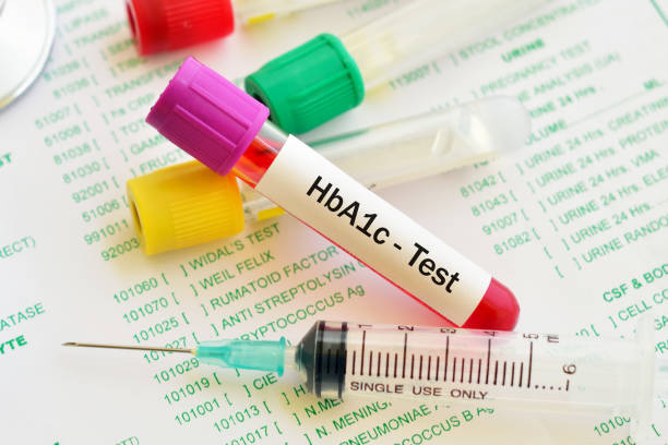 Best Hemoglobin A1c Test Stock Photos, Pictures & Royalty ...