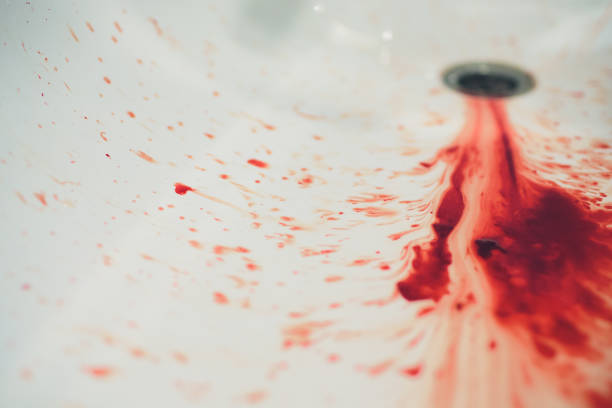 blood in basin,blood and washbasin in bath room,concept blood and basin in bath room. stock photo