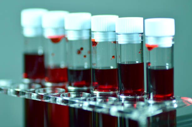 Blood laboratory tests stock photo