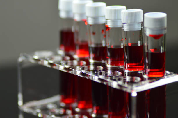 Blood laboratory tests stock photo