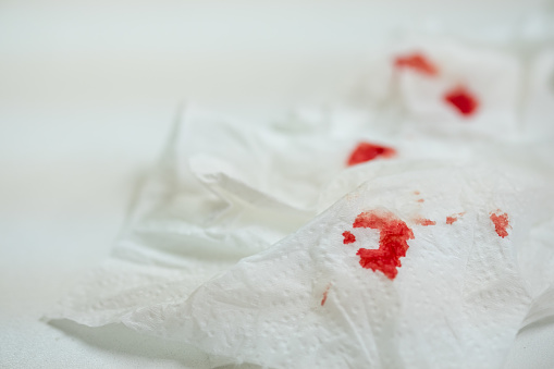 Blut am Toilettenpapier Gewebe. 