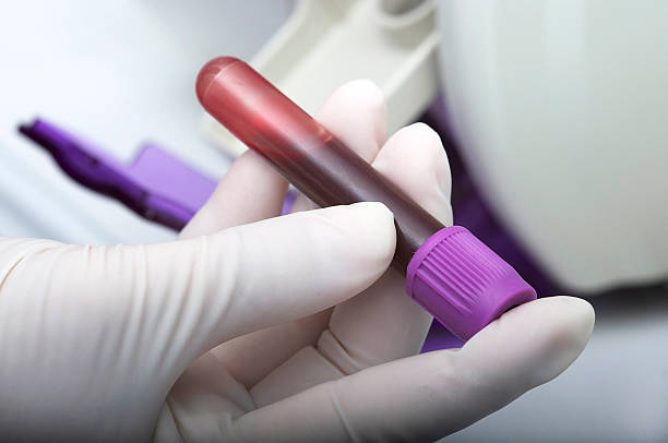 Blood sample Close-up of hand with glove, holding a blood sample in a tube blood testing stock pictures, royalty-free photos & images
