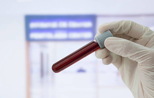 blood sample Medical technician holding a blood sample in tubes for test in front of the laboratory. blood testing stock pictures, royalty-free photos & images