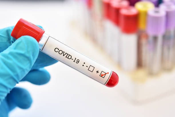 covid-19를 가진 혈액 견본 관 양성 - coronavirus 뉴스 사진 이미지