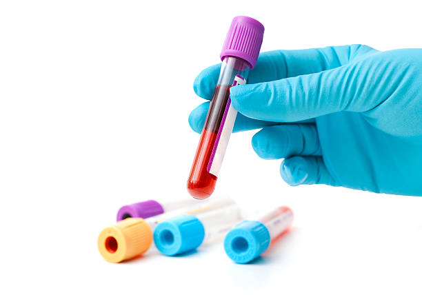blood samples hand in protective glove holding a blood sample blood testing stock pictures, royalty-free photos & images