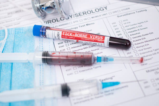 Blood samples with infected virus stock photo