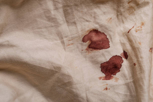 Blood stain on fabric stock photo